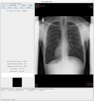 dicomimageviewerによる閲覧